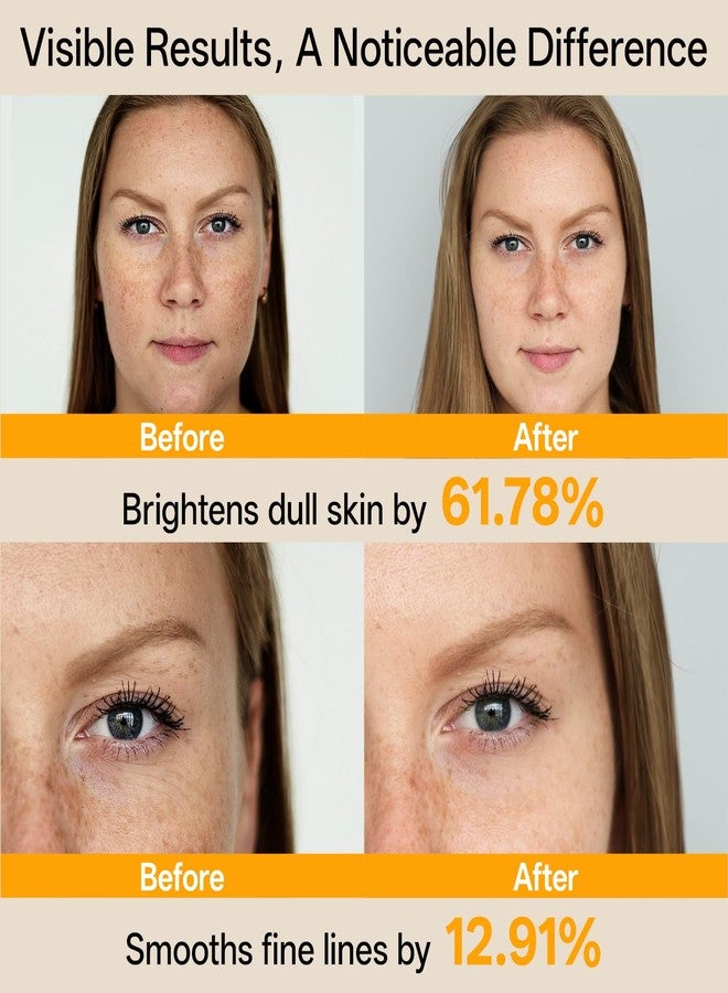 WNP Vitamin C Serum for Face - Dermatologist Tested Anti-Aging & Brightening with Hyaluronic Acid & Vitamin E, Treatment for Dark, Age, Sun Spot, Melasma, Hyperpigmentation, Fine Lines & Wrinkles - Image 3